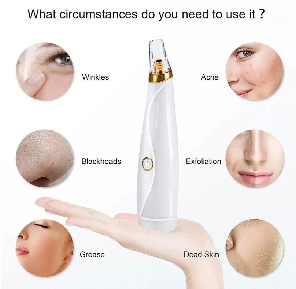 Black Head Remover Skin with 5 Tips