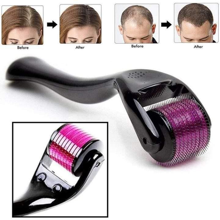 540 Titanium Derma Roller for Hair Growth & Skin Rejuvenation
