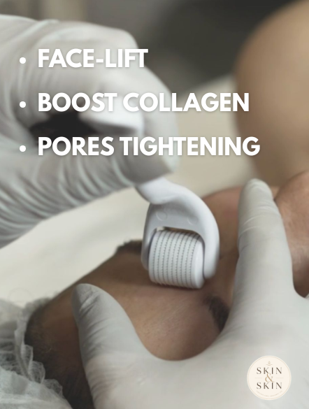 540 Titanium Derma Roller for Hair Growth & Skin Rejuvenation